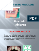 Mordida Abierta