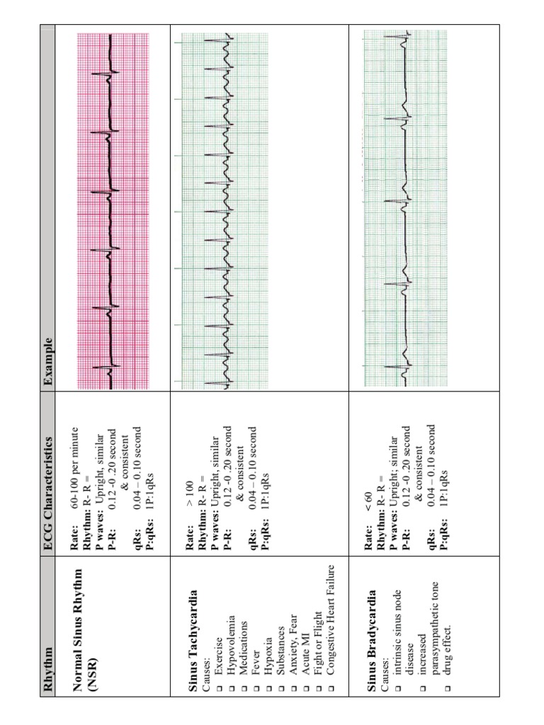 EKG Flash Cards PDF | PDF | Electrocardiography | Electrophysiology for Free Printable Ekg Practice Strips