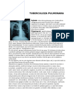 Tubrerculoza Pulmonara