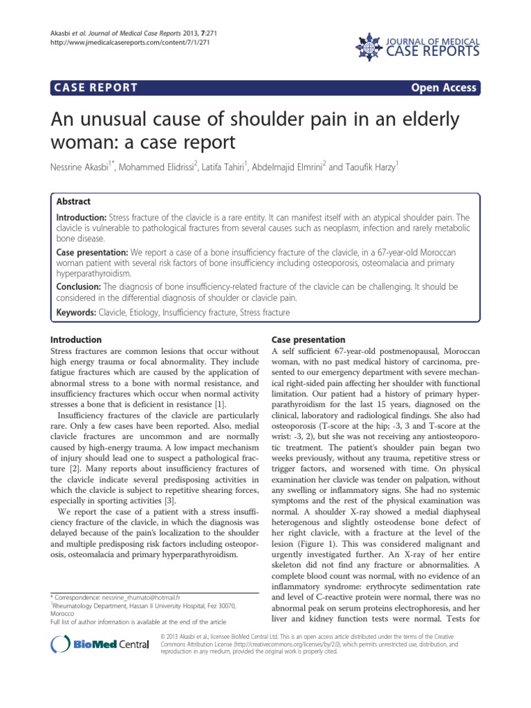 Osteoporosis thesis statement image