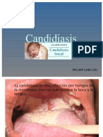 Candidiasis Bucal