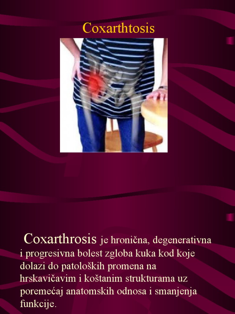 Koksartroza | PDF