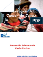Cancer de Cervix - Jemh