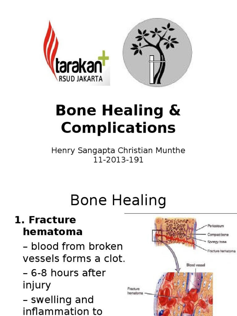 Bone Healing PDF Healing Bone