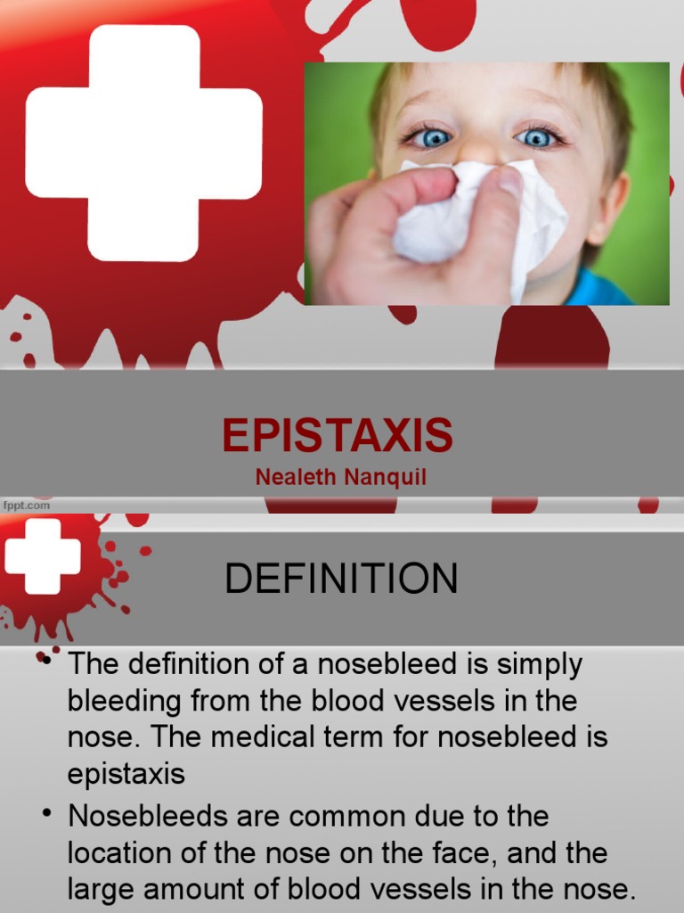 Epistaxis | Human Nose | Medical Specialties