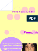 Pemphigus Vulgaris