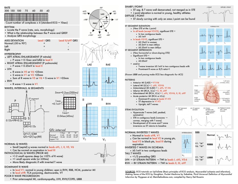 Ecgcheatsheet5 Pdf Electrocardiography Cardiac Electrophysiology