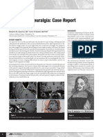 Trigeminal Neuralgia- Case Report and Review