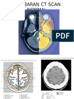 Gamba CT Scan Normal