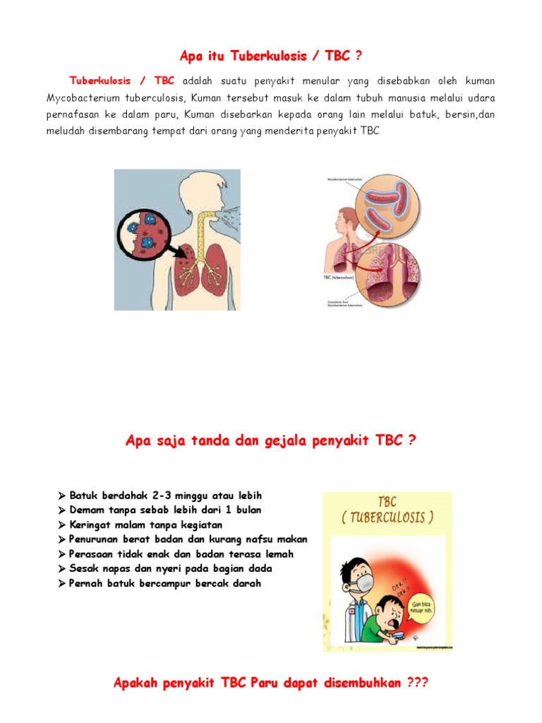 Lembar Balik Tb Tuberkulosis