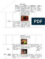 Keratitis