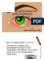 Asuhan Keperawatan Konjungtivitis