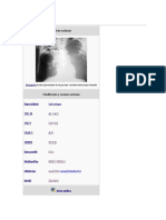 Tuberculosis.docx