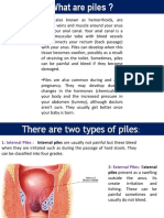 What Are Piles and Its Homeopathic Treatment.