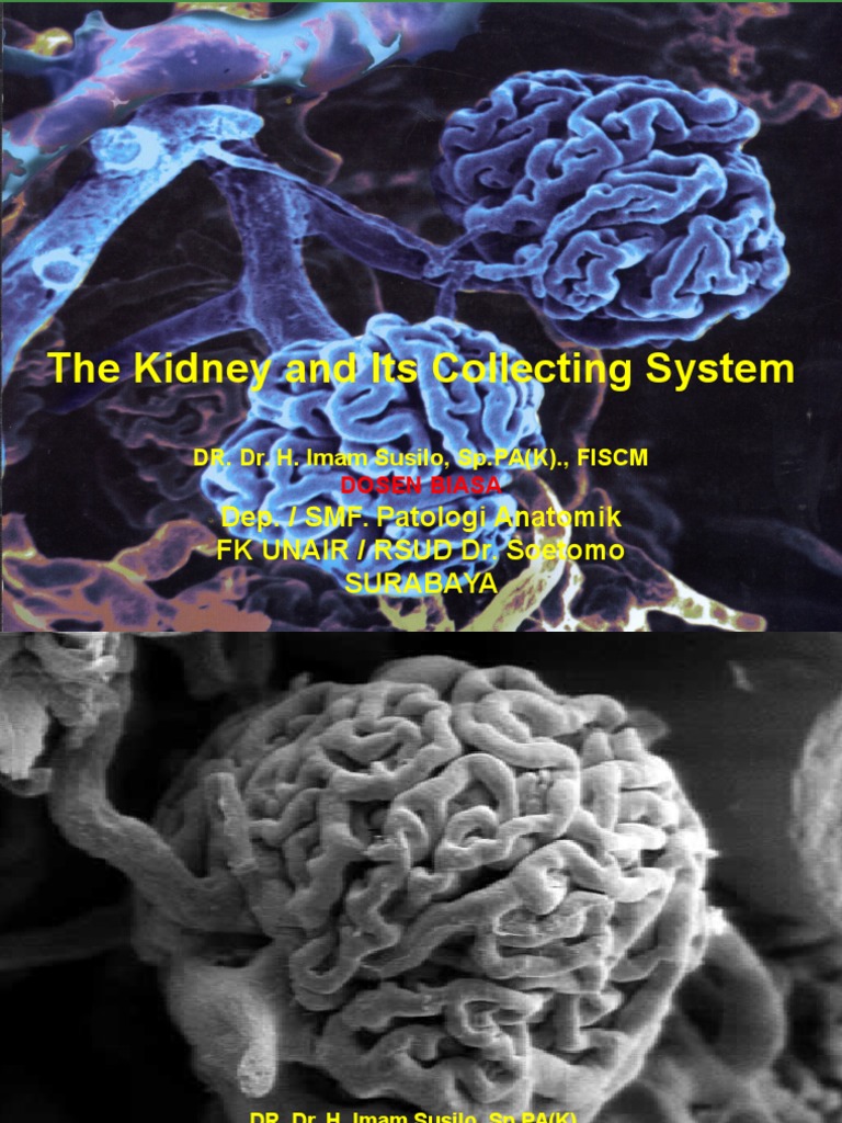 The Kidney and Its Collecting System: Dep. / SMF. Patologi Anatomik FK ...