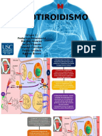 Expo Hipotiroidismo