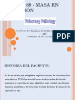 Caso de masa pulmonar por Cryptococcus neoformans en paciente post-trasplante hepático