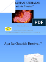 PENKES Gastritis Erosiva