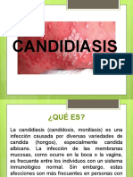 Candidiasis