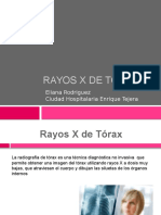 Rayos X de Tórax