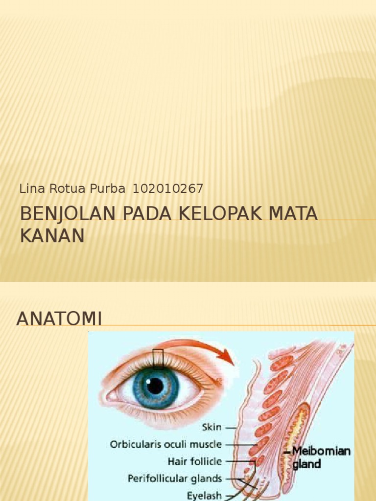 Kelopak Mata Kanan Atas - √ Arti Kedutan Kelopak Mata Kanan Atas Terus