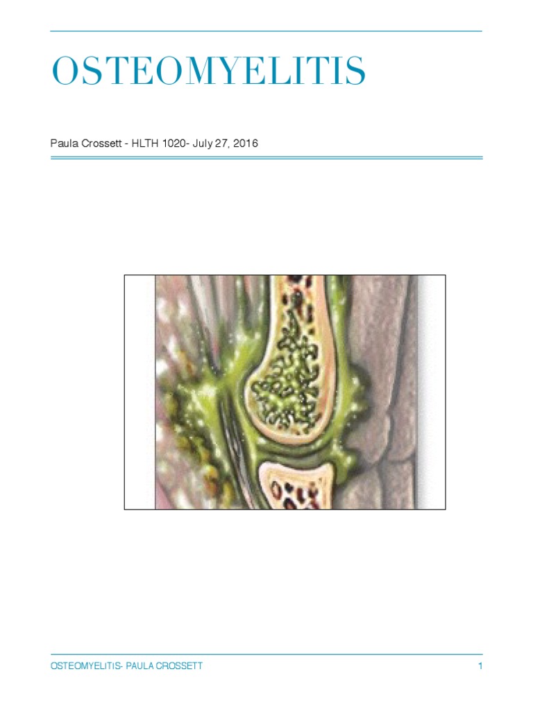Osteomyelitis cause image