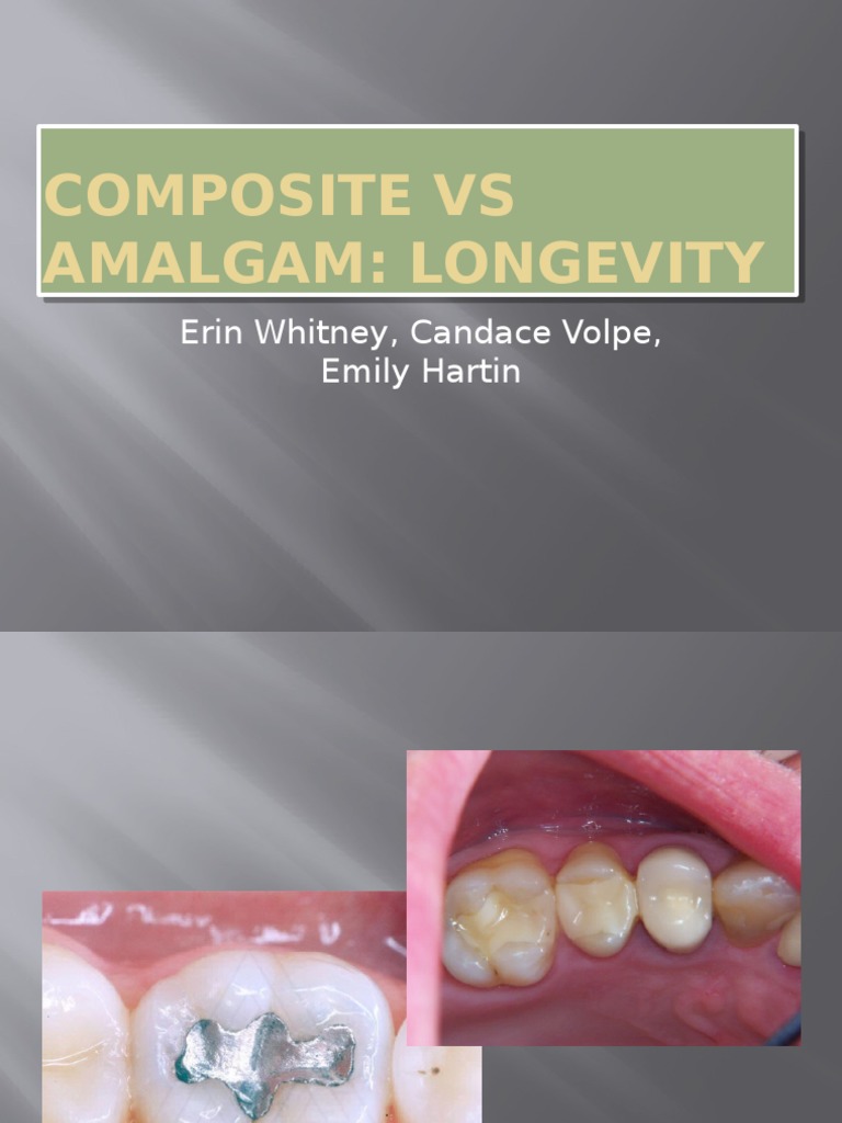 composite vs amalgam powerpoint Dental Composite Dentistry