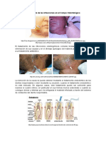 Tratamiento de Las Infecciones Odontologicas