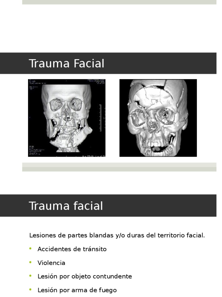 Clasificación y manejo del trauma facial | PDF | Lesión | Anatomía de ...