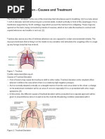 Tracheal Deviation - Causes and Treatment