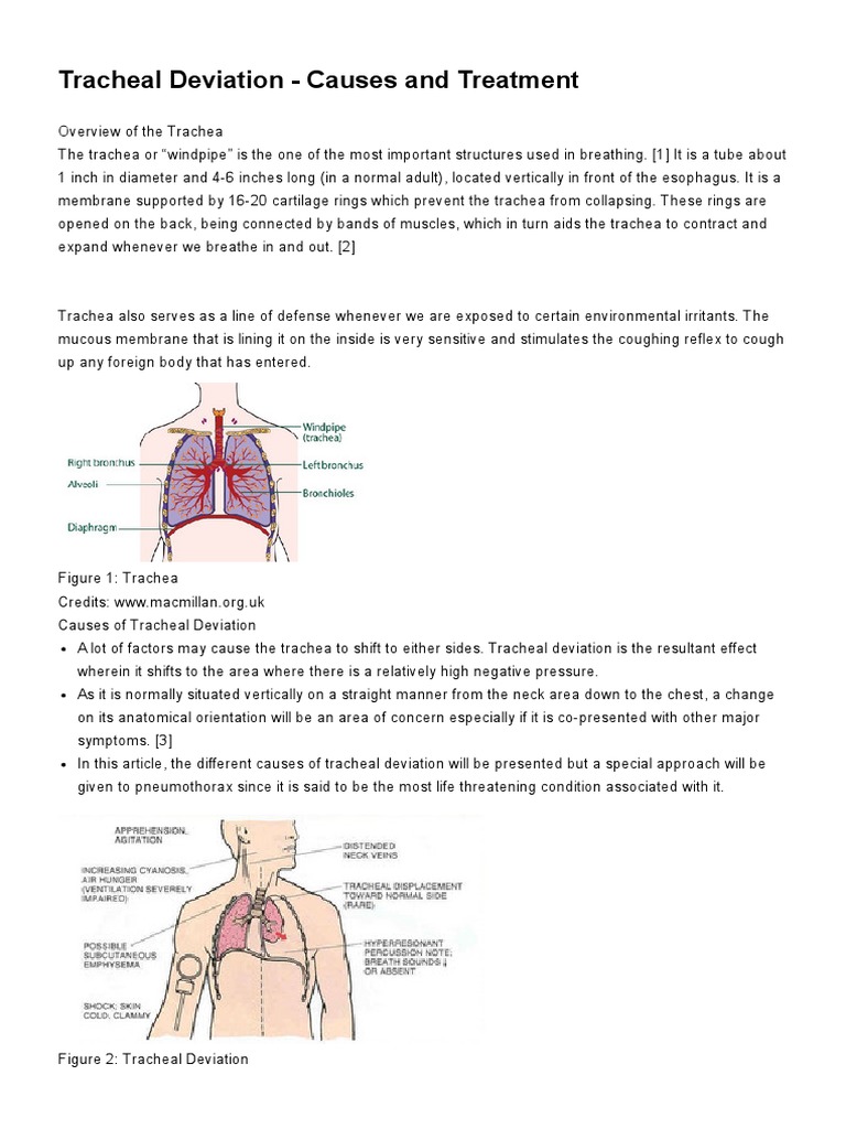 Tracheal Deviation Causes and Treatment Respiratory System