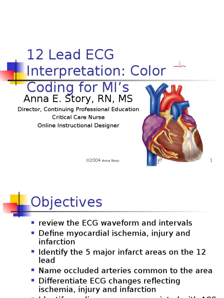 12 Lead ECG Color Codes 1_04(1) Electrocardiography Cardiology