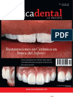 alta tecnica dental - restauraciones en ceramica