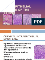 03 Intraepithelial Disease of The Cervix