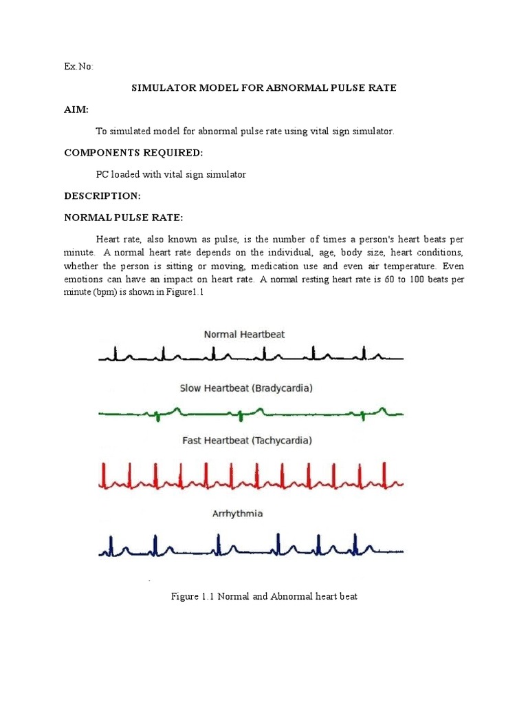 Medical Simulator for Pulse Rates | PDF | Heart Rate | Monitoring ...