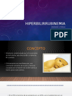 Hiperbilirrubinemia