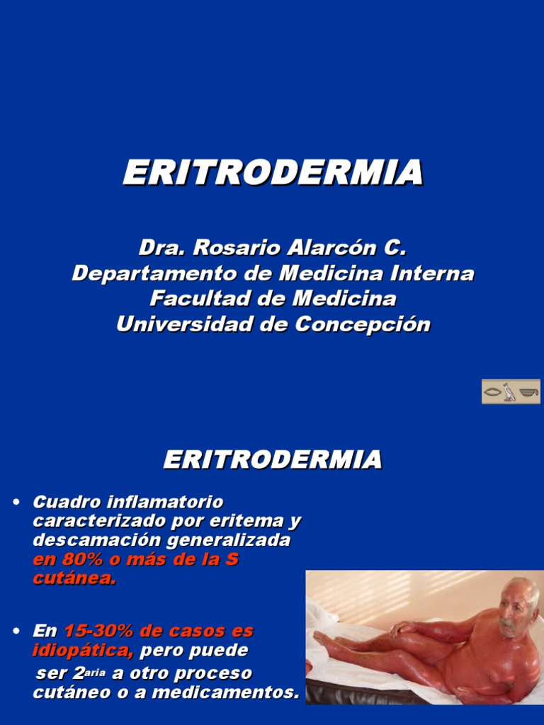 Eritrodermia: Causas y Clínica | PDF | Psoriasis | Epidermis