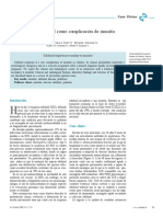 Empiema PDF