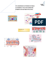 Mapa Mental de Inflamacion