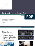 Protocolo en Prótesis Fija