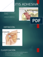 CAPSULITIS ADHESIVA.pptx