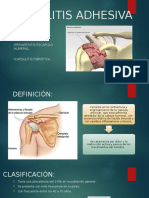 Capsulitis Adhesiva