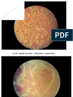Placas Embrio II Parcial Unah