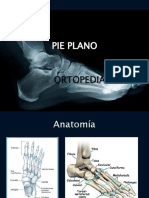 Pie Plano, Pie Valgo, Pie Varo