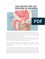 Conoce Las Causas Por Las Que La Próstata Se Enferma