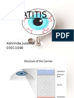 Ppt Referat Keratitis