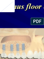 Sinus Floor Augmentation - Course NP