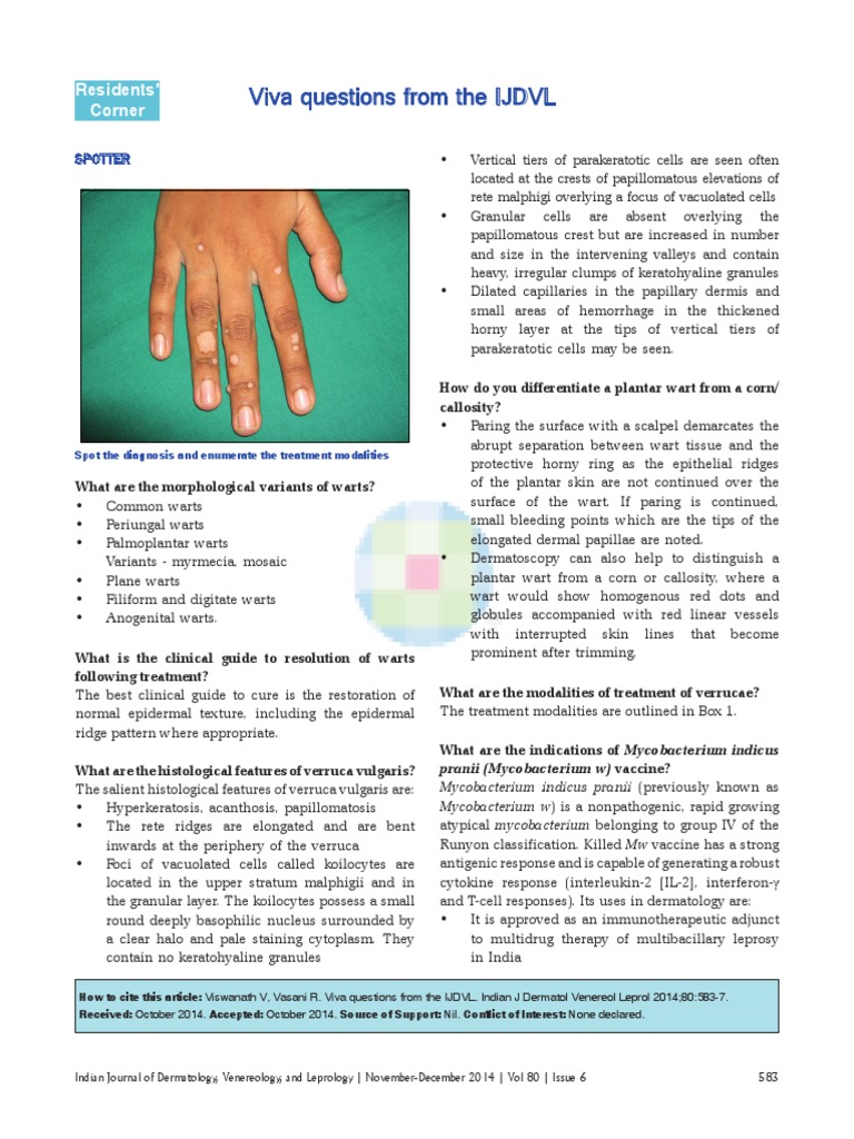 IJDVL Viva: Warts and Treatments | PDF | Immunotherapy | Cutaneous ...