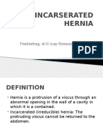 Incarserated Hernia