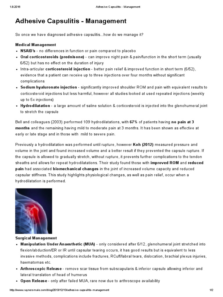 An Overview of Treatment Options for Adhesive Capsulitis Including
